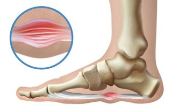 Boli vas stopalo kao iglom da vas bodu? Dva su uzroka najčešća, evo kako da ih izlečite sami kod kuće