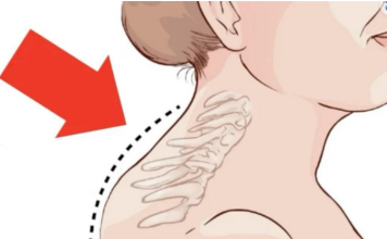 Kiropraktičar je pokazao 3 jednostavne vježbe koje će vam pomoći da uklonite “Grbu” u vratu: 0vo mi je najviše pomoglo! VIDEO