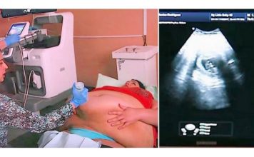 Trudna žena ima 226 kilograma i došla je na ultrazvuk, a onda je medicinska sestra podigla njen stomak i pogledala bolje… (VIDEO)