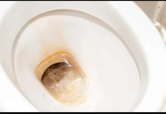 Odličan KUĆNI TRIK kako ukloniti žute mrlje i kamenac u WC šolji bez hemikalija: Testirano, djeluje odmah!