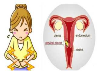 KLJUČNO ZA SPAS: Većina žena zanemari OVA TRI rana znaka raka grlića maternice!