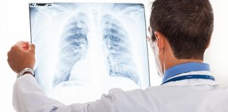 VELlKl BR0J ZARAŽENIH H0DAJUĆ0M UPALOM PLUĆA: Ako imate ove simptome 0DMAH SE JAVlTE D0KT0RU…