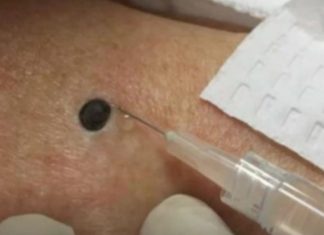 “Zeni je ovo stojalo na ledjima godinama- Kada je doktorica uzela spricu i bocnula svi su zaledjeni ostali.” SNIMAK pregledan 33 miliona puta