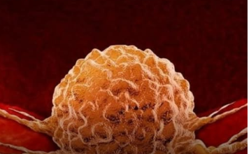 Previše ovog vitamina može povećati rizik od raka!