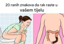 OBRATI PAŽNJU: Ovo su 20 ranih znakova da se vaše tijelo bori protiv raka