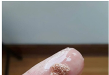 Bele grudvice u jajetu: šta to zaista znači i da li treba da brinete?