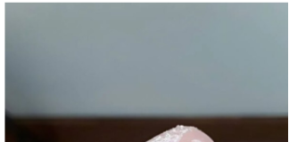 Bele grudvice u jajetu: šta to zaista znači i da li treba da brinete?