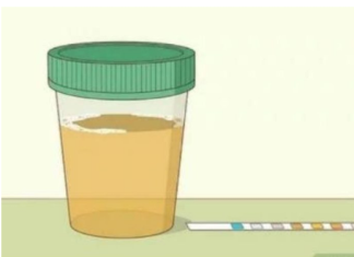 Koliko Puta Dnevno Mokrite? Evo Koliko je Normalno