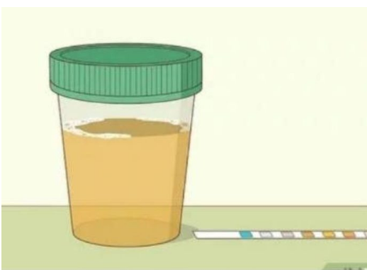 Koliko Puta Dnevno Mokrite? Evo Koliko je Normalno