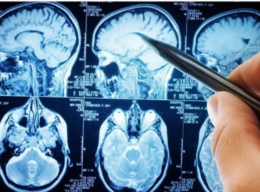 Najzdravije povrće na svijetu: Naučnici kažu da mozak može učiniti 11 godina mlađim