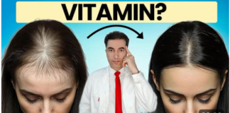 OPASNO: Deficit ovog vitamina UZROKUJE gubitak kose kod žena !