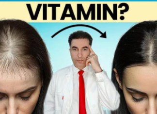 OPASNO: Deficit ovog vitamina UZROKUJE gubitak kose kod žena !