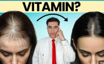 OPASNO: Deficit ovog vitamina UZROKUJE gubitak kose kod žena !