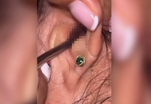 SVRBELO JE UVO DO BESVESTI, OTIŠLA U BOLNICU, A TAMO ŠOK: Kada su videli šta je unutra nisu mogli da veruju svojim očima! (FOTO)