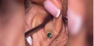 SVRBELO JE UVO DO BESVESTI, OTIŠLA U BOLNICU, A TAMO ŠOK: Kada su videli šta je unutra nisu mogli da veruju svojim očima! (FOTO)