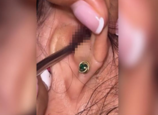 SVRBELO JE UVO DO BESVESTI, OTIŠLA U BOLNICU, A TAMO ŠOK: Kada su videli šta je unutra nisu mogli da veruju svojim očima! (FOTO)