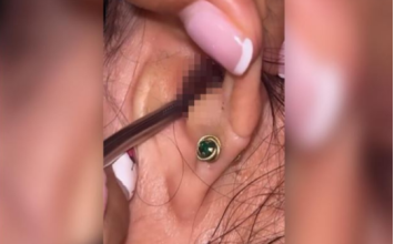 SVRBELO JE UVO DO BESVESTI, OTIŠLA U BOLNICU, A TAMO ŠOK: Kada su videli šta je unutra nisu mogli da veruju svojim očima! (FOTO)