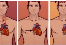 1 ZNAK NA KOŽI UKAZUJE DA JE VAŠE SRCE U LOŠEM STANJU: Ako ovo primijetite javite se doktoru ODMAH!