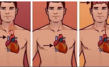 1 ZNAK NA KOŽI UKAZUJE DA JE VAŠE SRCE U LOŠEM STANJU: Ako ovo primijetite javite se doktoru ODMAH!