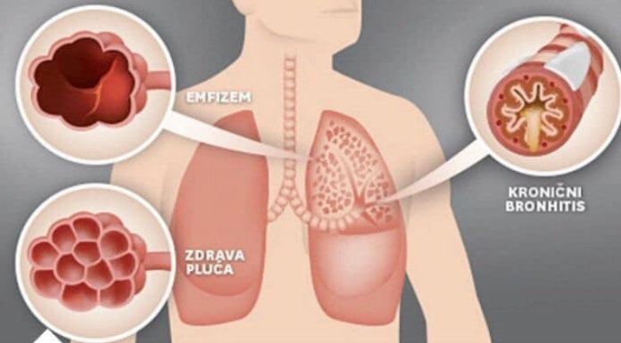 NAŠE BAKE SU NAJBOLJE ZNALE: Evo kako izliječiti astmu, bronhitis i plućne bolesti