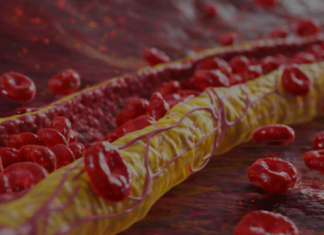 Ovi znaci na nogama pokazuju da imate izuzetno visok holesterol: Ne smijete ih ignorisati, posljedice su fatalne po tijelo