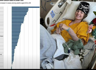Otkriven joj je rak crijeva sa 24 godine – postojała su tri ključna simptoma koje je ignorisala