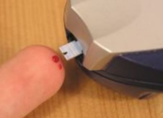 Najraniji znak da vam šećer razara organizam: Obratite pažnju na 1 opasan simptom