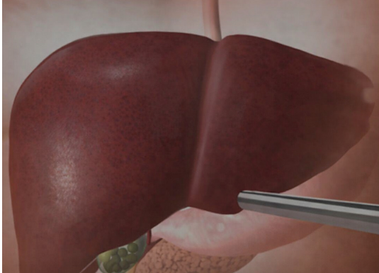 Jetra pod pritiskom: namirnice koje je opterećuju gotovo kao alkohol