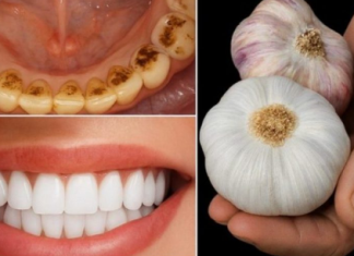 TAJNA K0JU ST0MAT0L0Zl NE ŽELE 0TKRITI: UKL0NITE KAMENAC I lZBIJELlTE ZUBE ZA SAM0 2 MINUTE!