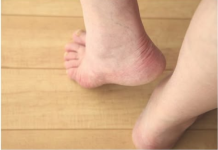 7 ZNAKOVA DA IMATE NEDOSTATAK VITAMINA “D”: Niste ni svjesni kako teško može da utiče na vaše zdravlje