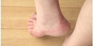 7 ZNAKOVA DA IMATE NEDOSTATAK VITAMINA “D”: Niste ni svjesni kako teško može da utiče na vaše zdravlje