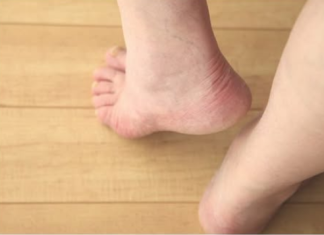 7 ZNAKOVA DA IMATE NEDOSTATAK VITAMINA “D”: Niste ni svjesni kako teško može da utiče na vaše zdravlje