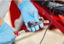 Većina 100-godišnjaka ima istu krvnu grupu