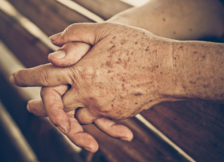 PRIMJETILI STE DA VAM SE POJAVLJUJU STARAČKE PJEGE : To je znak da imate ozbiljan problem sa jednim organom!