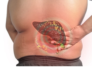 Sve veći broj ljudi ima masnu jetru: Uzrok nije alkohol, već jedan sastojak za koji svi misle da je zdrav