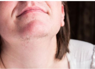 EVO ZAŠTO ŽENE IMAJU DLAKAVU BRADU! Ovo vam organizam govori!