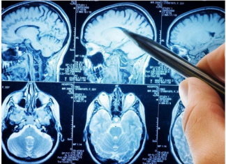 POVRĆE JE TOLIKO ZDRAVO DA O NJEMU PIŠE NJUJORK TAJMS: Amerikanci daju po 30 dolara za jedan list, a ono raste kod nas