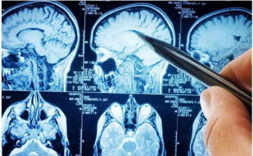 POVRĆE JE TOLIKO ZDRAVO DA O NJEMU PIŠE NJUJORK TAJMS: Amerikanci daju po 30 dolara za jedan list, a ono raste kod nas