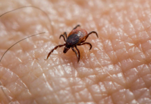 Ova stvar na čarapi najbolje tjera krpelje