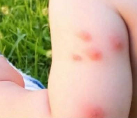 KOMARCI VAM PRAVE PAKAO OD ŽIVOTA? Samo isijecite OVO VOĆE na pola i ostavite u sobi, VIŠE IH NIKADA NEĆETE VIDJETI BLIZU!