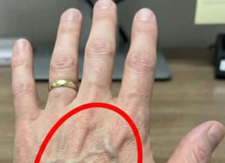 Ako imaš vidljive vene, to znači da si…😨😨‼️ - featured image